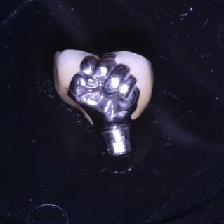 A prototype of White's dental implant. Photo by Andrew Nette.