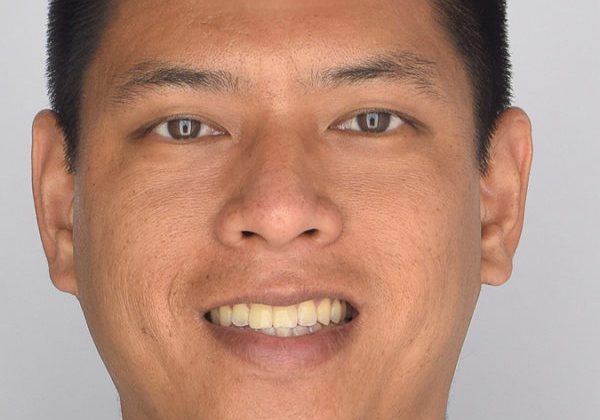 Womensvolleyballmentalskillscoachcover_ProvidedbyAndrewLing Profile of Andrew Ling.